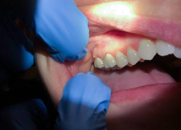 Best Weekend Emergency Dentist in La Croft, OH