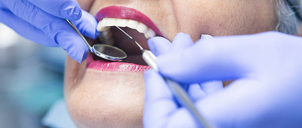 Best Emergency Dentist for Special Needs Patients in La Croft, OH